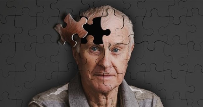 Alzheimer üç aşamada gelişiyor